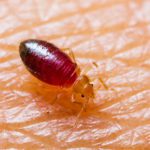 bed bug on skin - call Arrow Services for bed bug extermination service in Florida